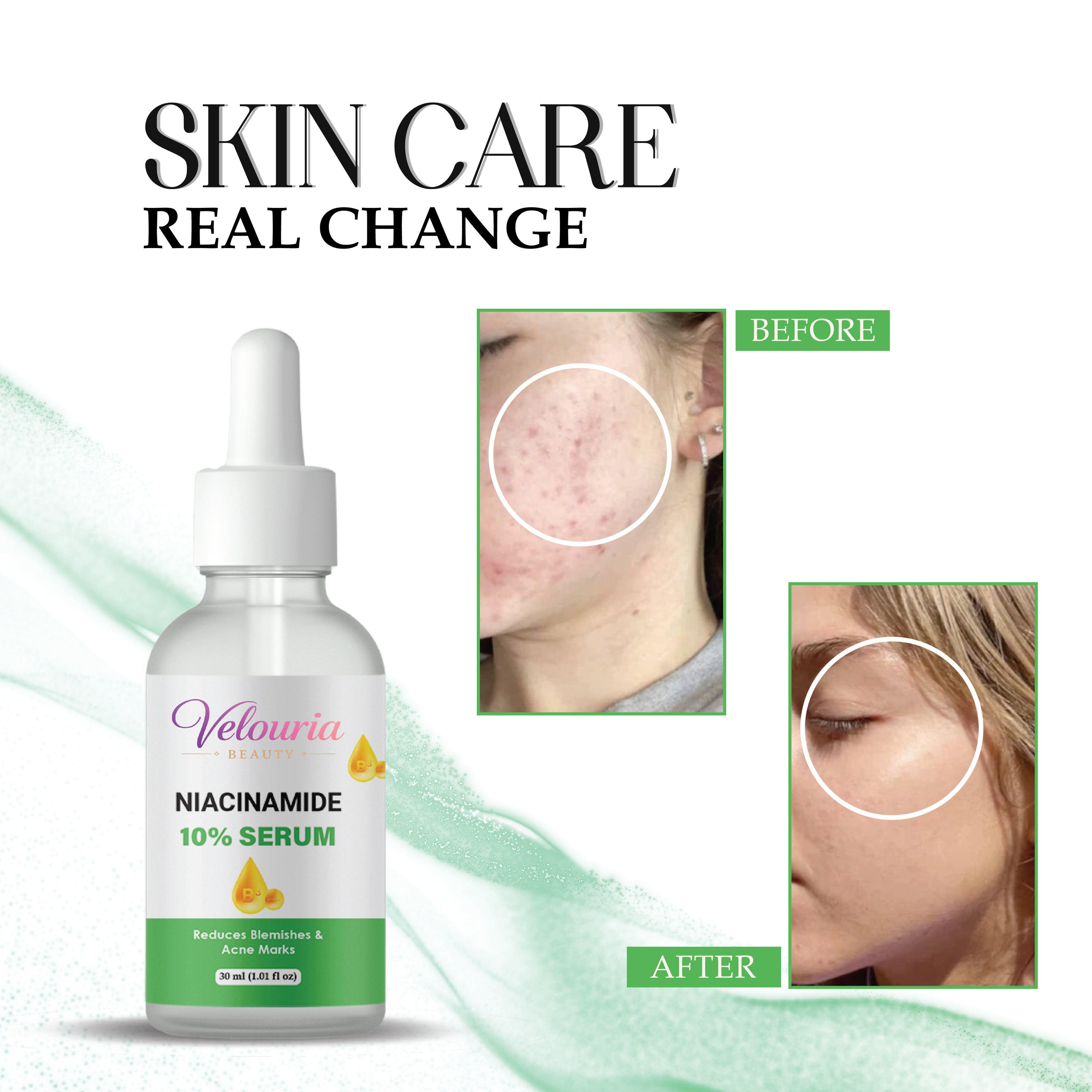 Velouria Beauty Niacinamide 10% Serum, Reduces Blemishes and Acne Marks, 30 ml