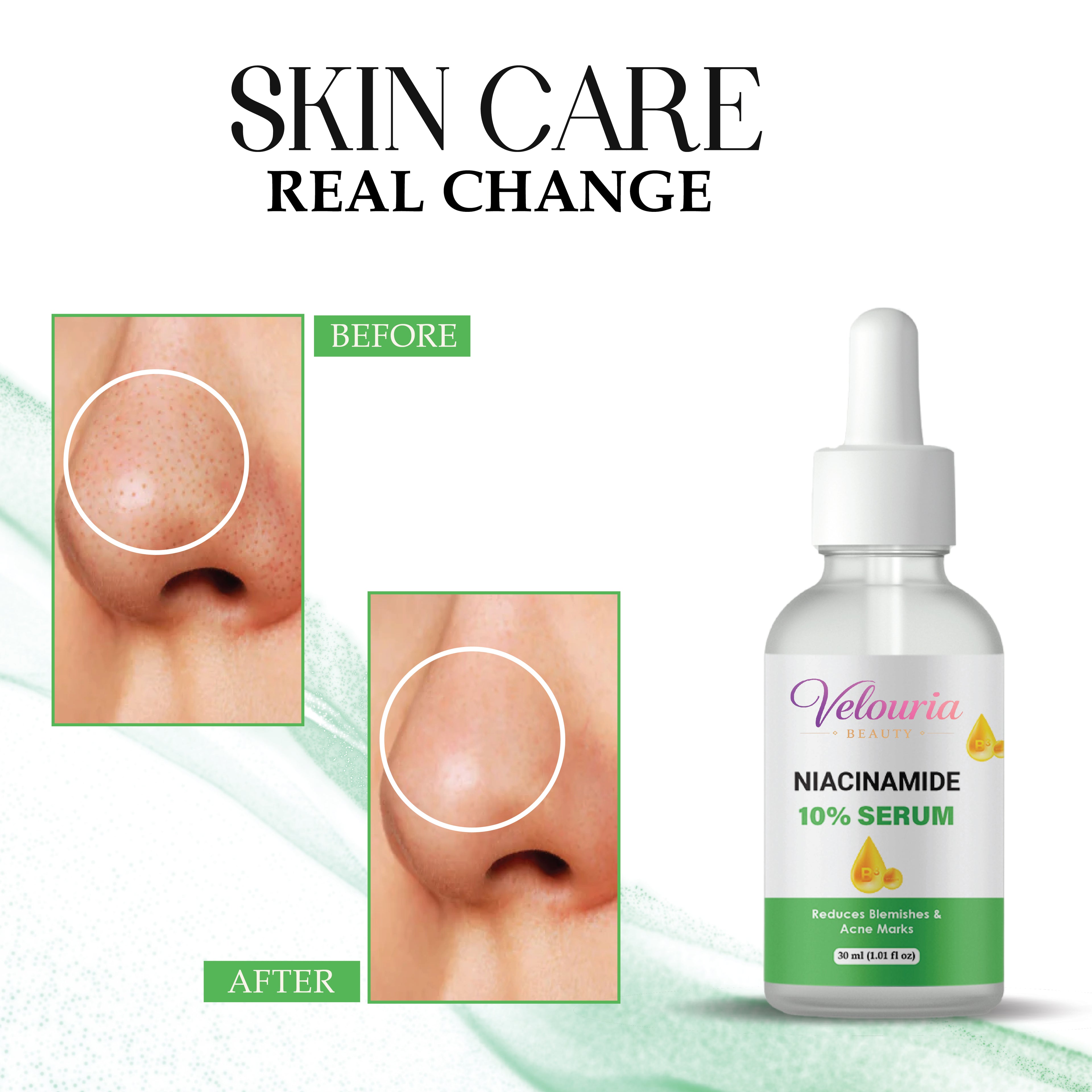 Velouria Beauty Niacinamide 10% Serum, Reduces Blemishes and Acne Marks, 30 ml