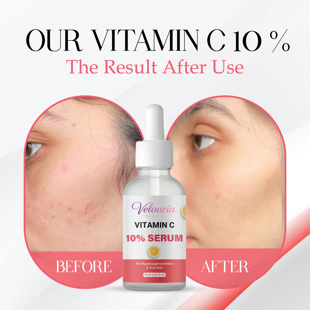 Velouria Beauty Vitamin C 10% Serum, Dull Skin, Blemish Reduction, Unscented, 30 ml