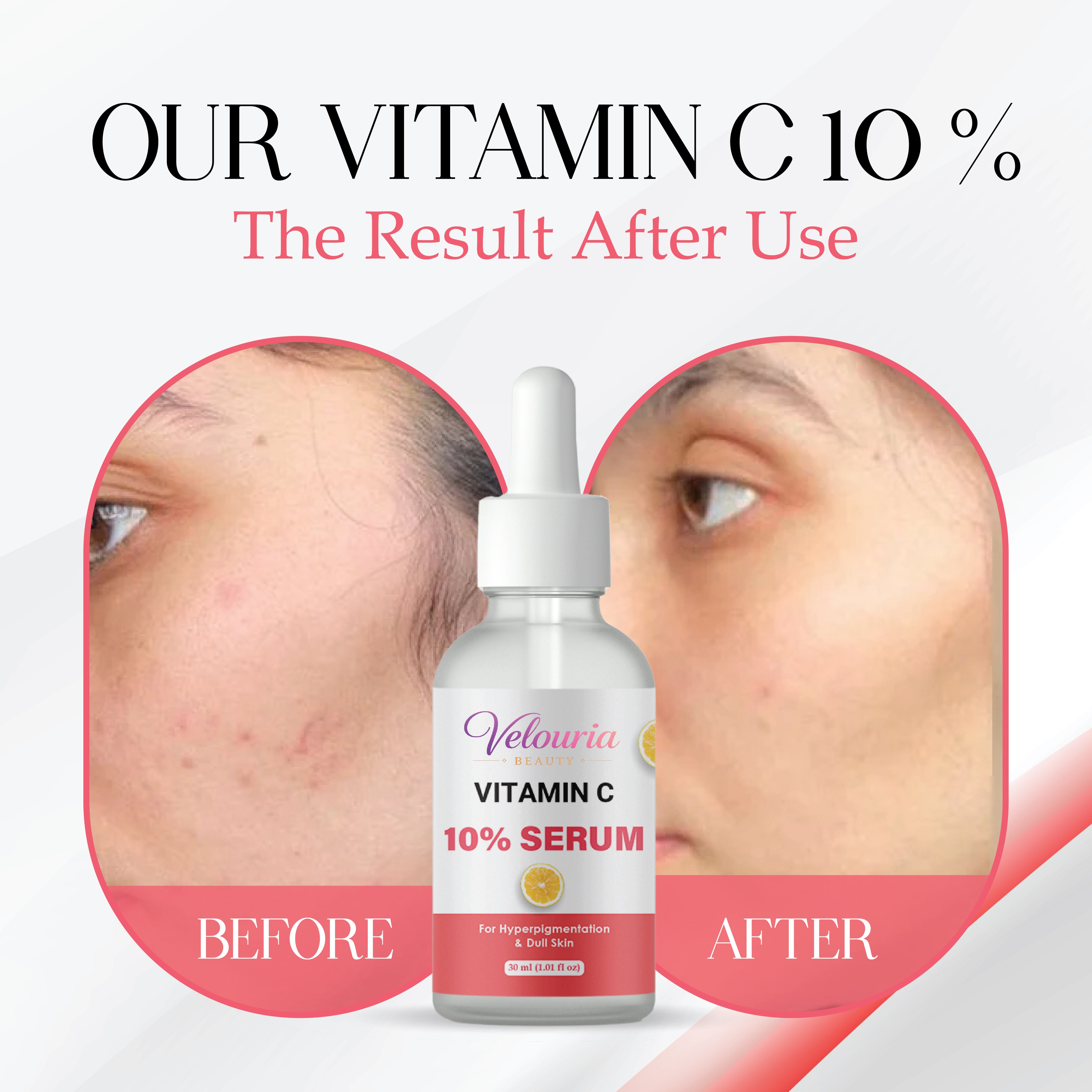 Velouria Beauty Vitamin C 10% Serum, Dull Skin, Blemish Reduction, Unscented, 30 ml