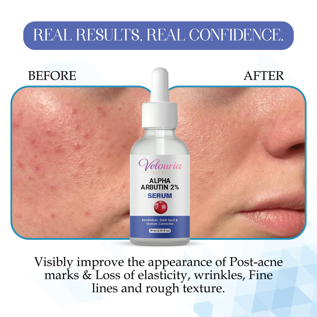 Velouria Beauty Alpha Arbutin 2% Serum, Dark Spot & Texture Corrector, Revitalizer, 30 ml