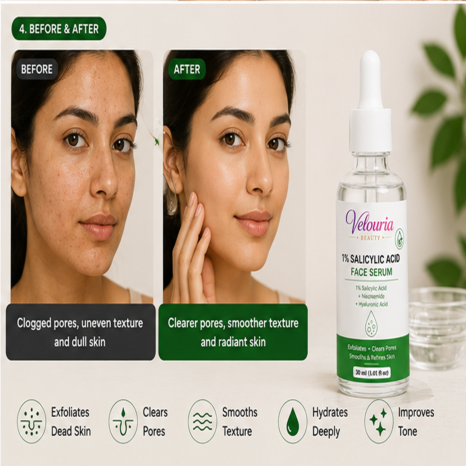 Velouria Beauty Anti Acne Face Serum Tea Tree Extract | Acne Control & Pimple Reduction Serum for Men & Women | Lightweight Oil Control Formula | 30 ml (1% Salicylic Acid Serum)