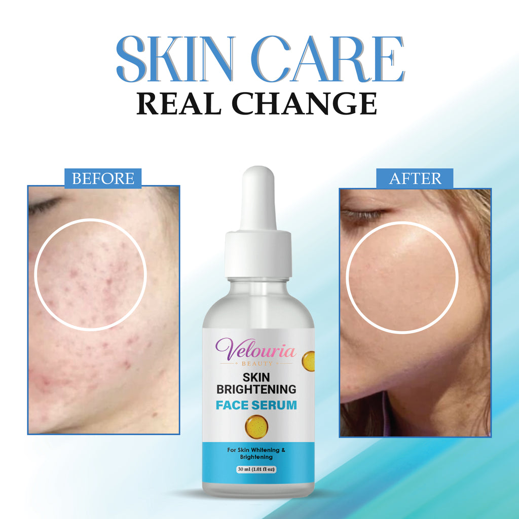 Velouria Beauty Skin Brightening Face Serum for Dark Spots and Uneven Skin Tone, 30 ml