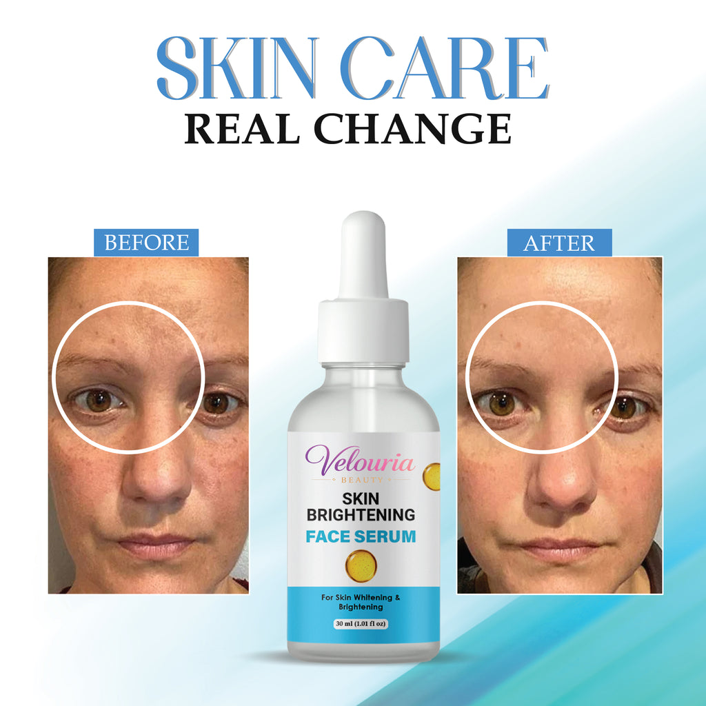 Velouria Beauty Skin Brightening Face Serum for Dark Spots and Uneven Skin Tone, 30 ml